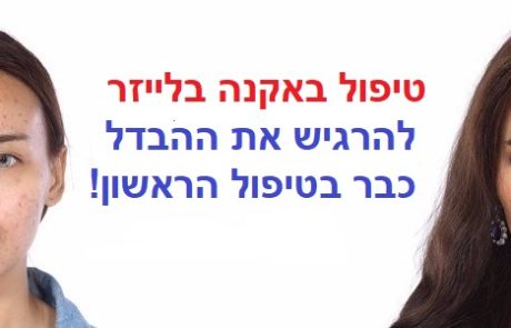 טיפול באקנה בפנים – בלייזר חדשני במרכזים המובילים ליד ביתך