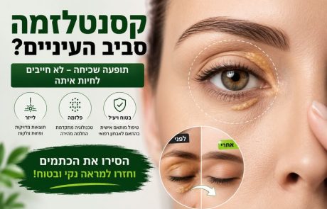 קסנטלזמה סביב העיניים – האם מדובר בבעיה רפואית או אסתטית?