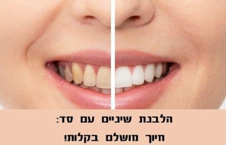 הלבנת שיניים עם סד: פתרון יעיל ונוח להשגת חיוך לבן ובוהק